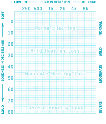 audiogram grid